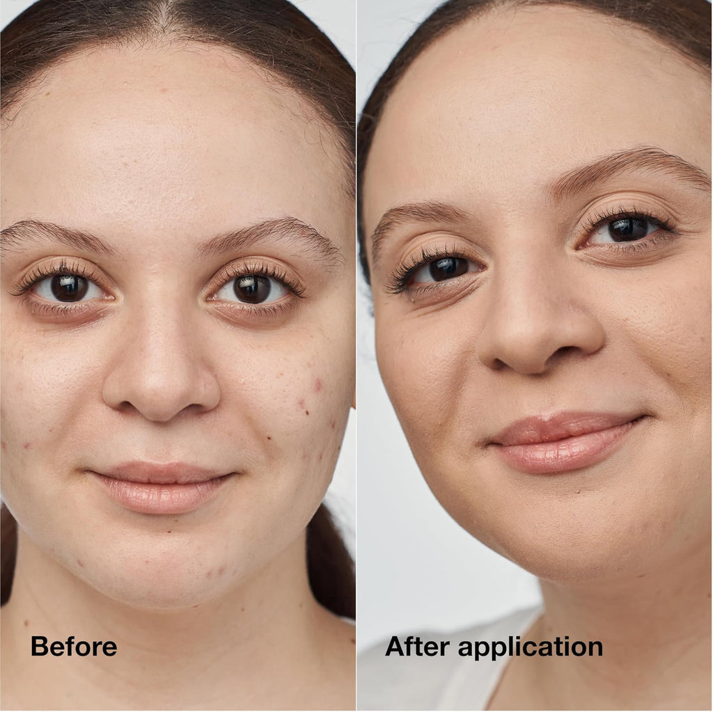 Clinique Even Better Clinical Serum Full Coverage Hydrating Foundation Broad Spectrum SPF 25 With Vitamin C, Salicylic Acid + Hyaluronic Acid For Oily Skin Types